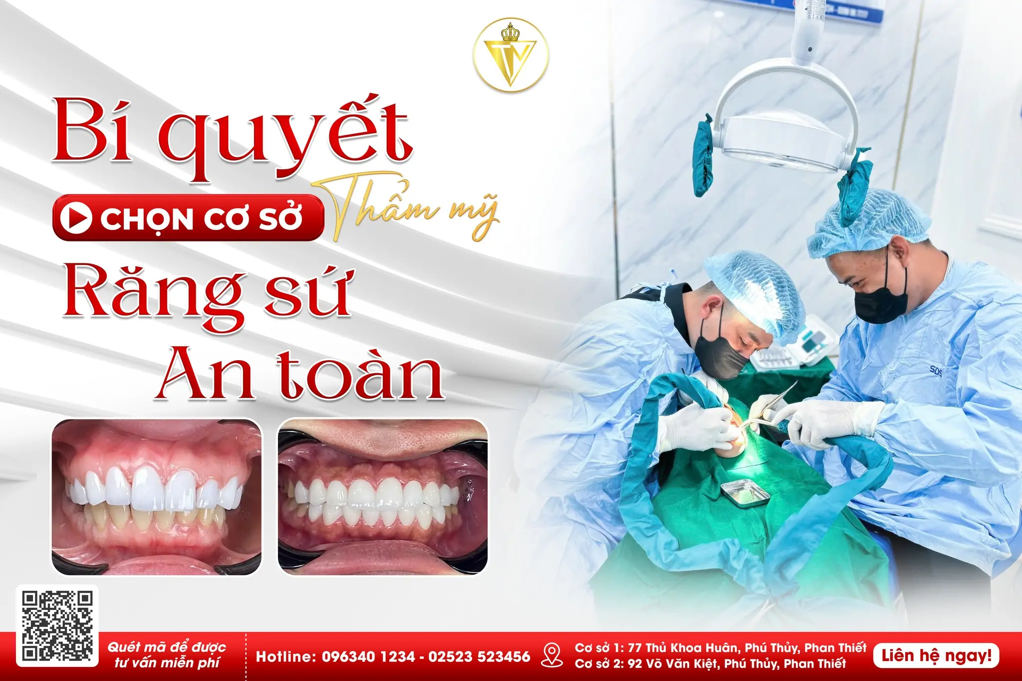 Răng Sứ Thẩm Mỹ – Giải Pháp Tái Tạo Nụ Cười Tự Nhiên & Bền Đẹp