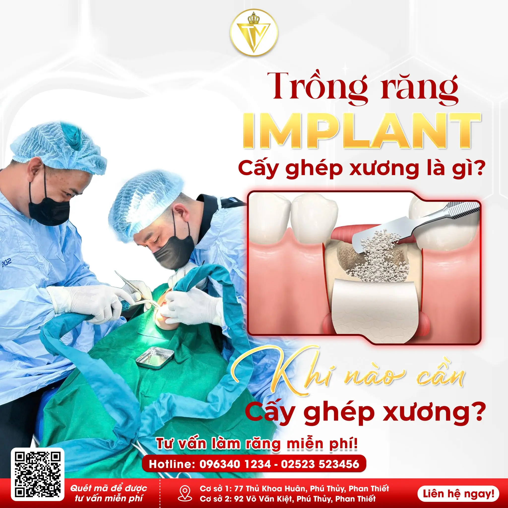 Trồng Răng Implant – Phục Hồi Răng Mất Bền Vững & Tự Nhiên