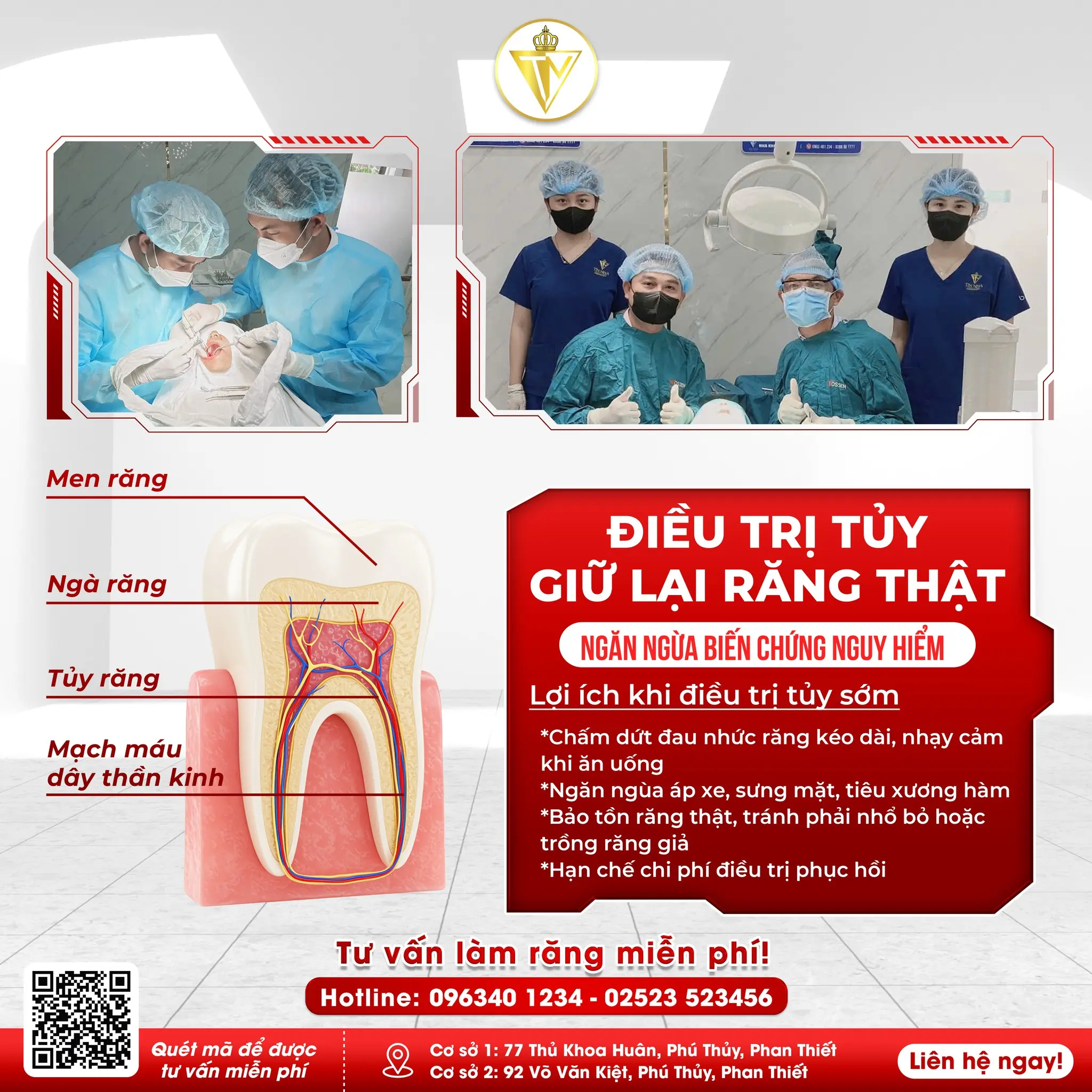  ĐIỀU TRỊ TỦY – GIỮ LẠI RĂNG THẬT, ĐỪNG ĐỂ MẤT RỒI MỚI TIẾC